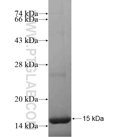 LHFPL2 fusion protein Ag18868 SDS-PAGE