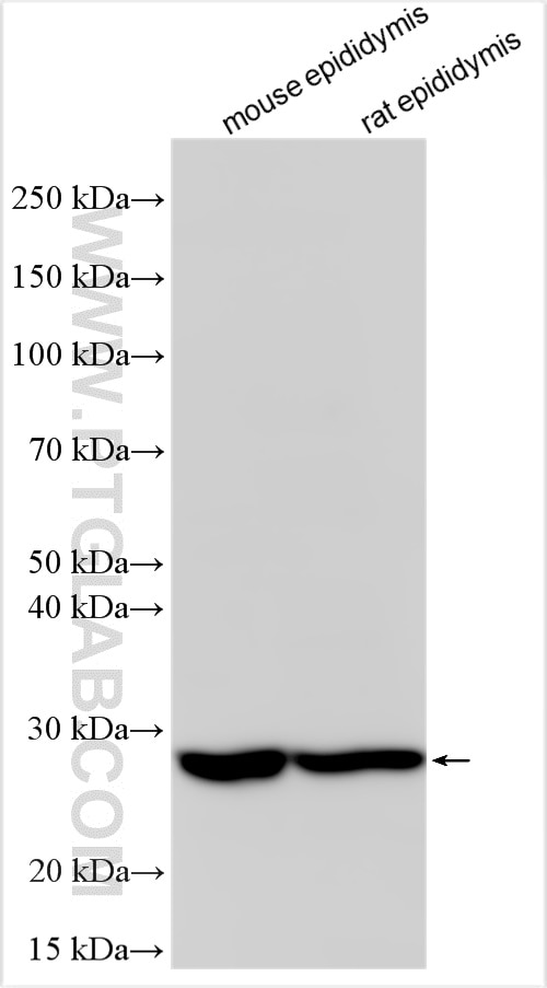 Western Blot (WB) analysis of various lysates using LHFPL5 Polyclonal antibody (21058-1-AP)
