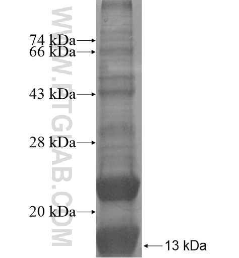 LHFPL5 fusion protein Ag14821 SDS-PAGE
