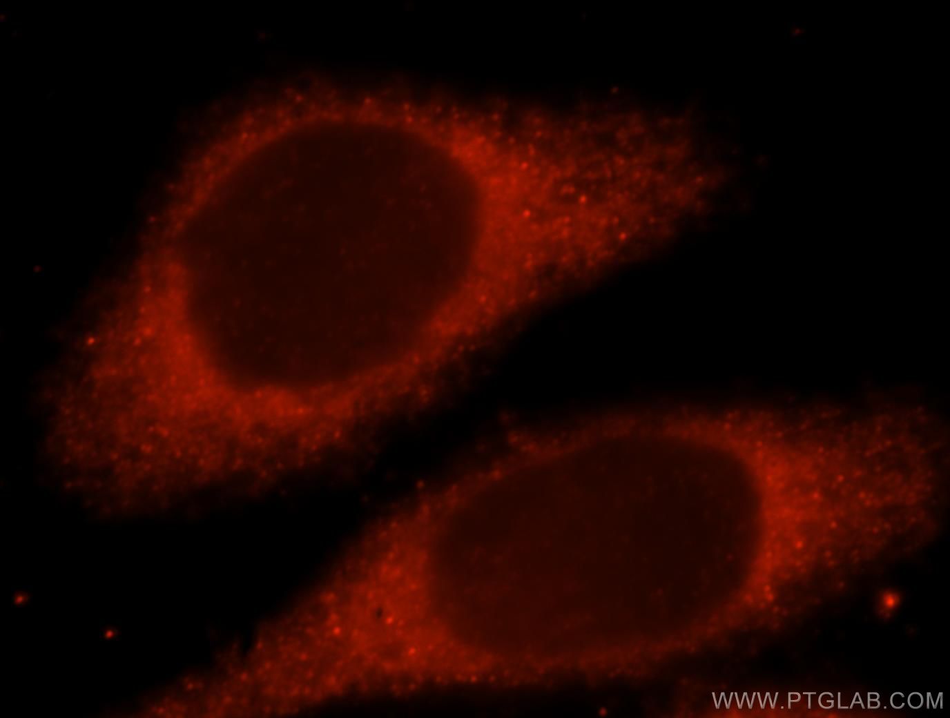 Immunofluorescence (IF) / fluorescent staining of HeLa cells using LHPP Polyclonal antibody (15759-1-AP)