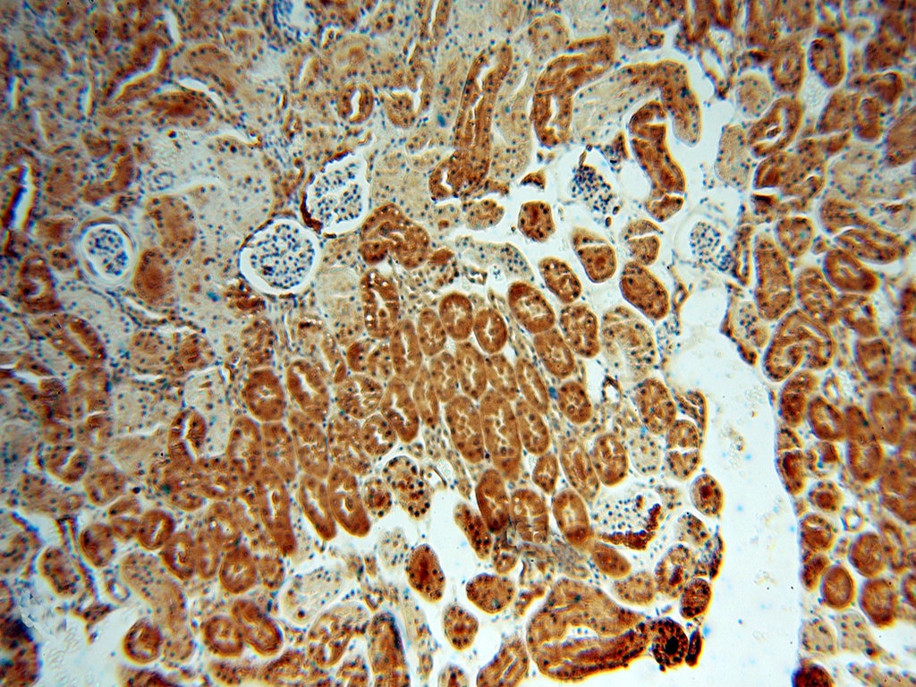 Immunohistochemistry (IHC) staining of human kidney tissue using LHPP Polyclonal antibody (15759-1-AP)