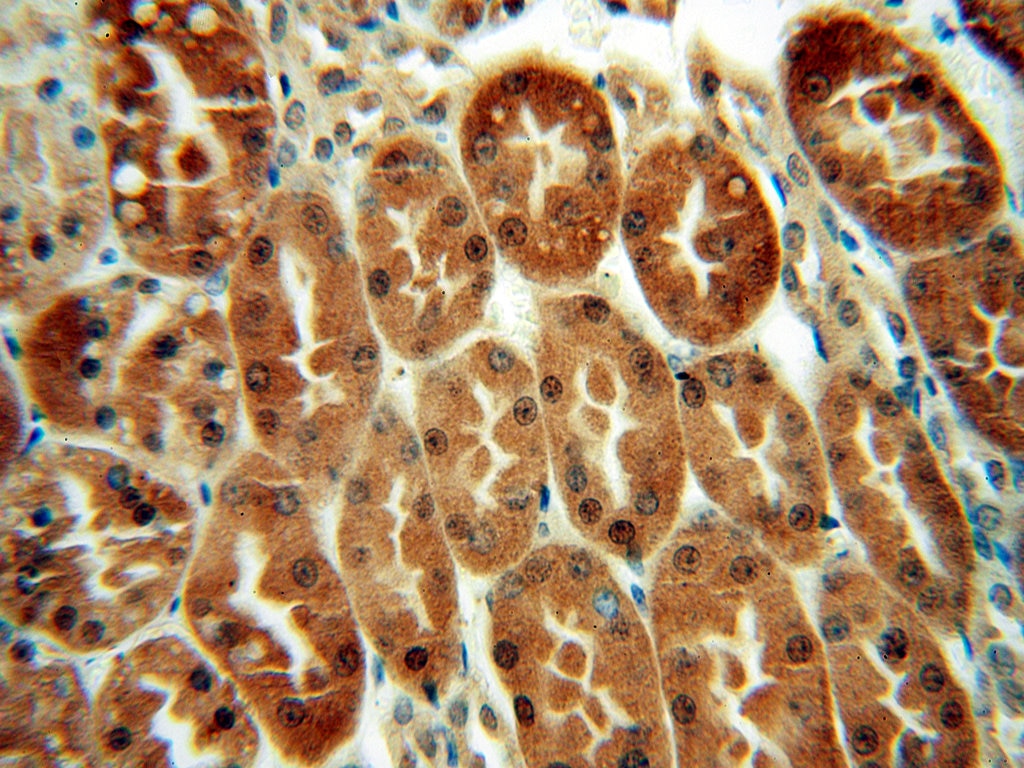 Immunohistochemistry (IHC) staining of human kidney tissue using LHPP Polyclonal antibody (15759-1-AP)