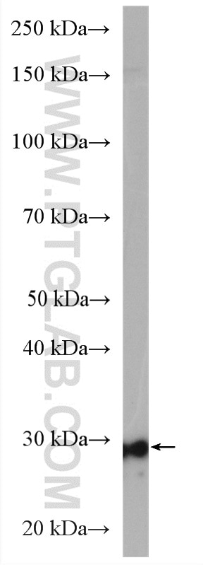 Western Blot (WB) analysis of A549 cells using LHPP Polyclonal antibody (15759-1-AP)