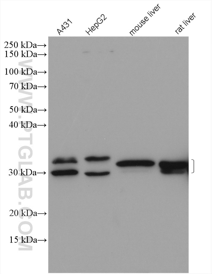 Western Blot (WB) analysis of various lysates using LHPP Polyclonal antibody (15759-1-AP)