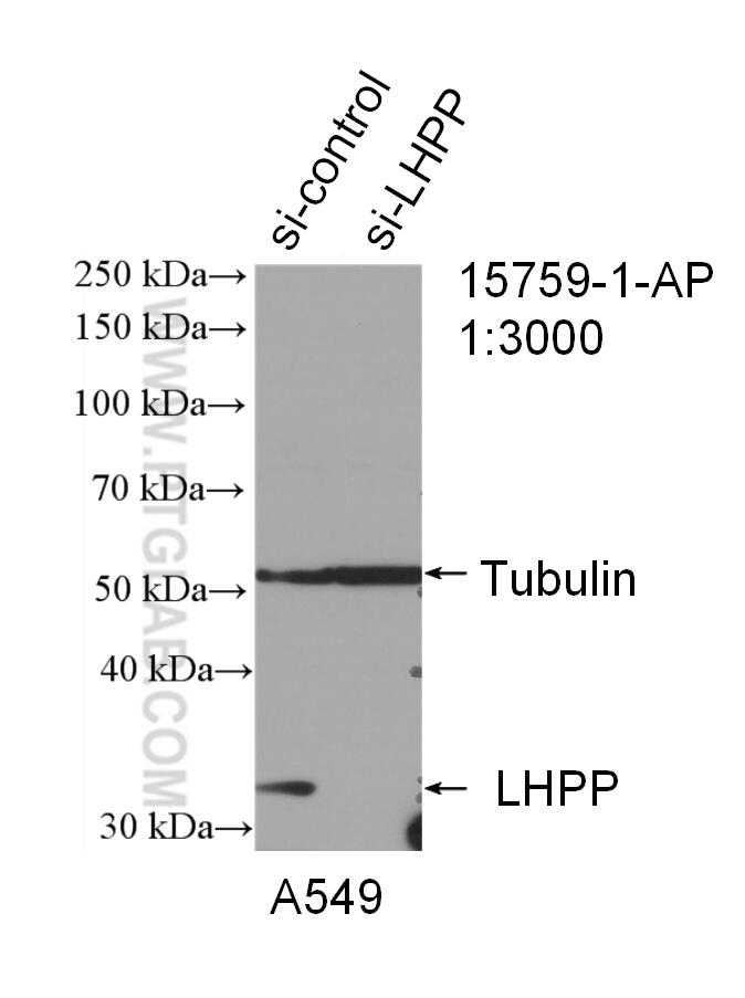 Western Blot (WB) analysis of A549 cells using LHPP Polyclonal antibody (15759-1-AP)