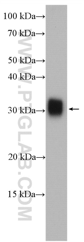 Western Blot (WB) analysis of mouse liver tissue using LHPP Polyclonal antibody (15759-1-AP)
