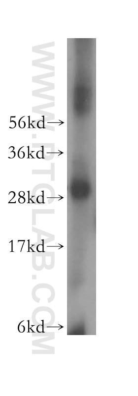 Western Blot (WB) analysis of human liver tissue using LHPP Polyclonal antibody (15759-1-AP)