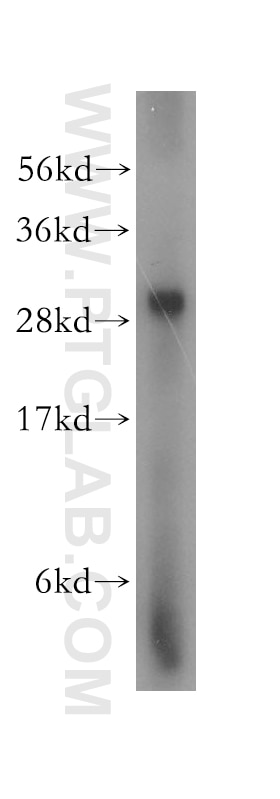 Western Blot (WB) analysis of human brain tissue using LHPP Polyclonal antibody (15759-1-AP)