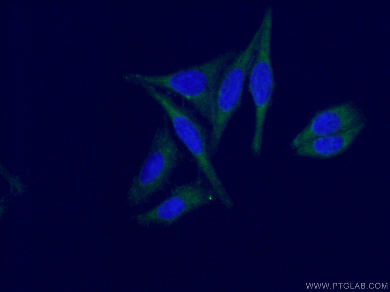 Immunofluorescence (IF) / fluorescent staining of HepG2 cells using LHPP Monoclonal antibody (66988-1-Ig)