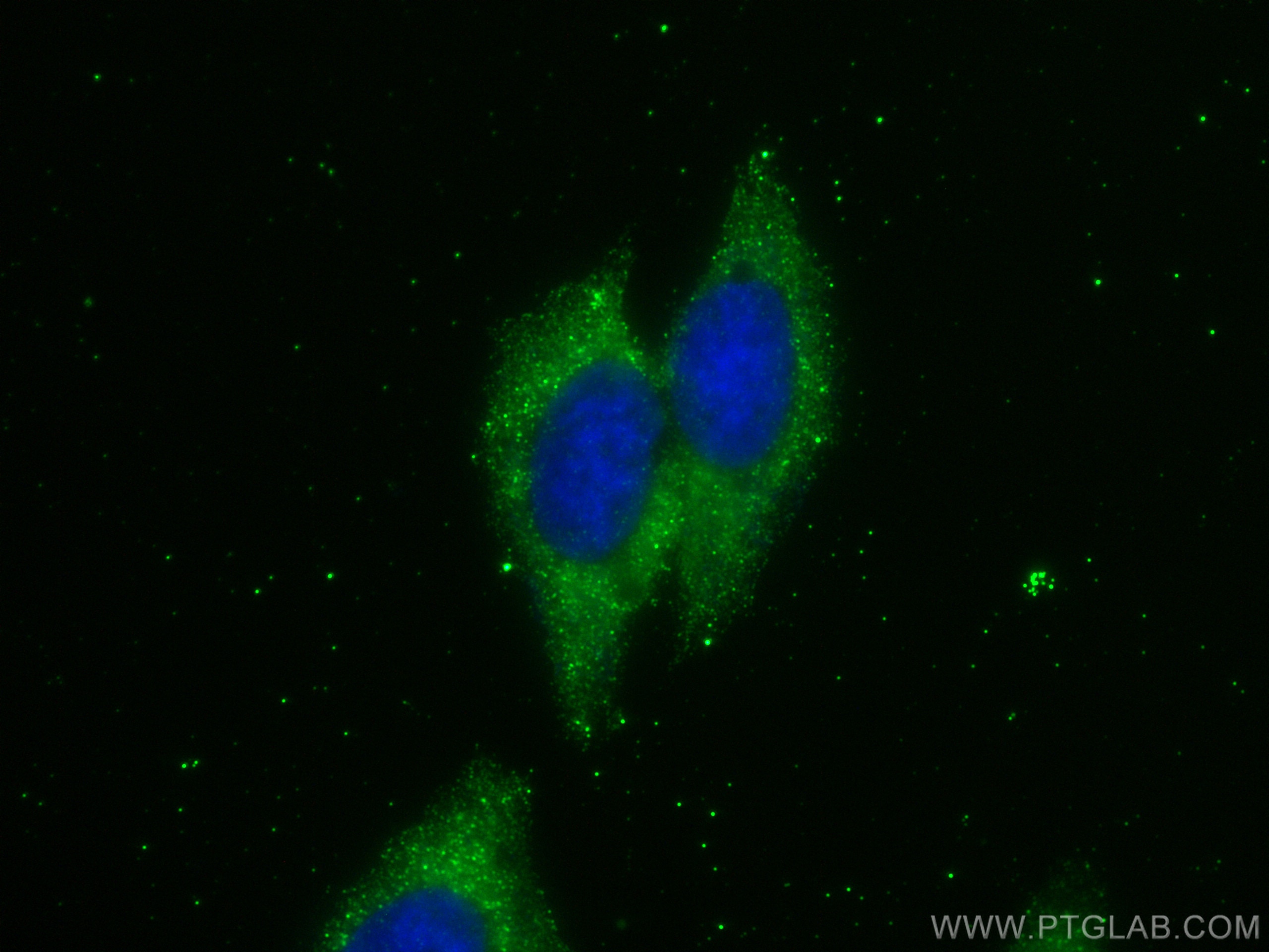 Immunofluorescence (IF) / fluorescent staining of HepG2 cells using LHPP Monoclonal antibody (66988-1-Ig)
