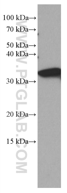 Western Blot (WB) analysis of pig liver tissue using LHPP Monoclonal antibody (66988-1-Ig)