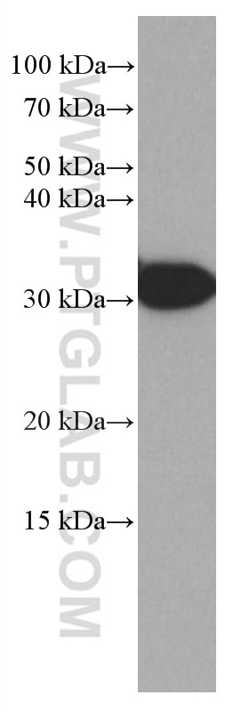 Western Blot (WB) analysis of rat liver tissue using LHPP Monoclonal antibody (66988-1-Ig)
