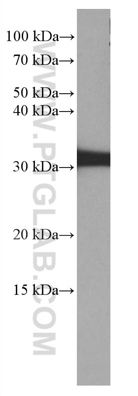 Western Blot (WB) analysis of mouse brain tissue using LHPP Monoclonal antibody (66988-1-Ig)