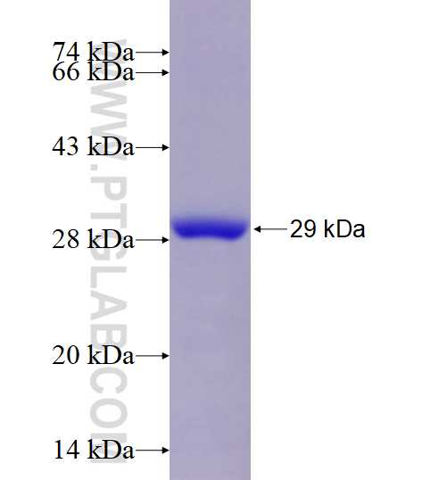 LHPP fusion protein Ag8375 SDS-PAGE