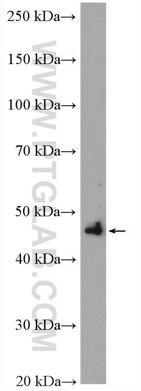 Western Blot (WB) analysis of mouse brain tissue using LHX5 Polyclonal antibody (21567-1-AP)