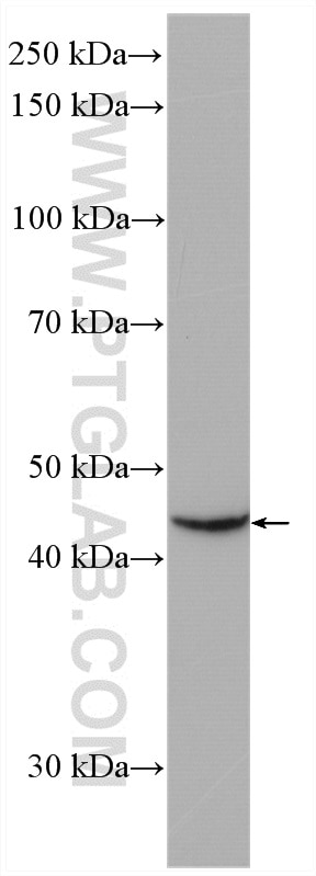 Western Blot (WB) analysis of HEK-293 cells using LHX5 Polyclonal antibody (21567-1-AP)