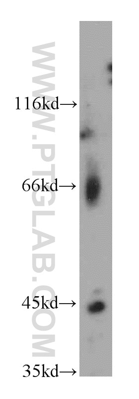 Western Blot (WB) analysis of human brain tissue using LHX5 Polyclonal antibody (21567-1-AP)