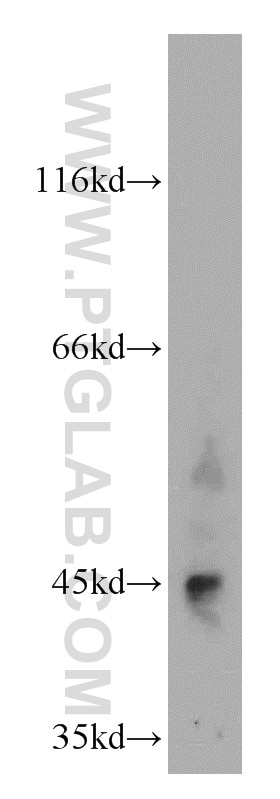 Western Blot (WB) analysis of HEK-293 cells using LHX5 Polyclonal antibody (21567-1-AP)