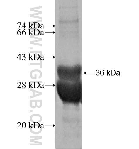 LHX6 fusion protein Ag16047 SDS-PAGE