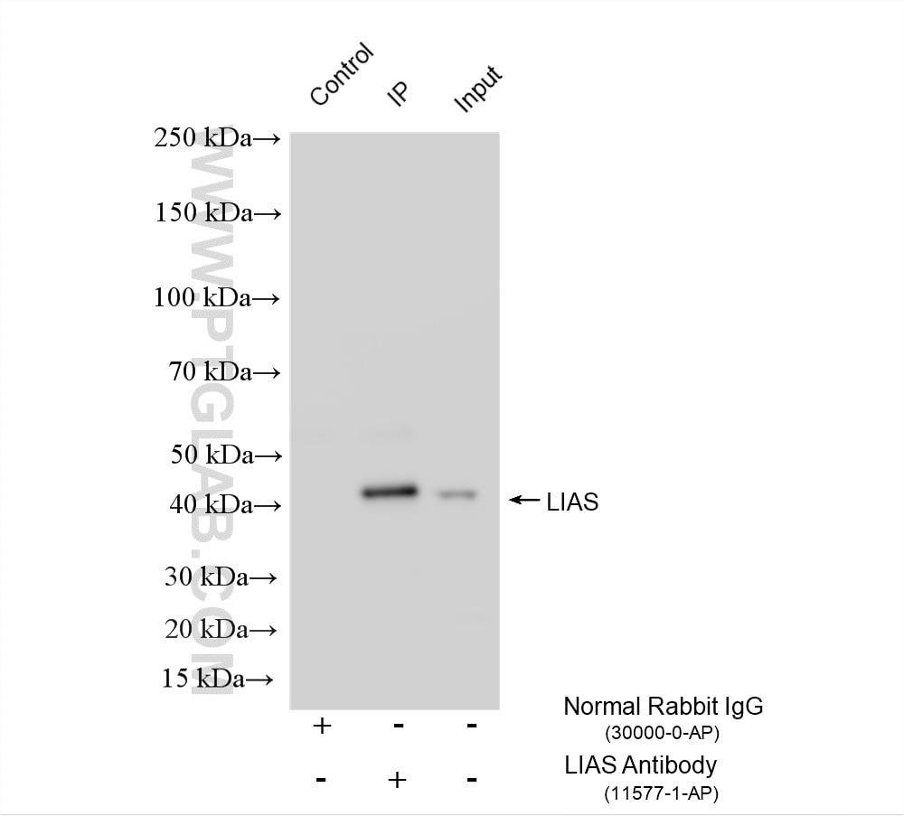 IP experiment of L02 using 11577-1-AP Immunoprecipitation (IP) experiment of L02 cells using LIAS Polyclonal antibody (11577-1-AP)
