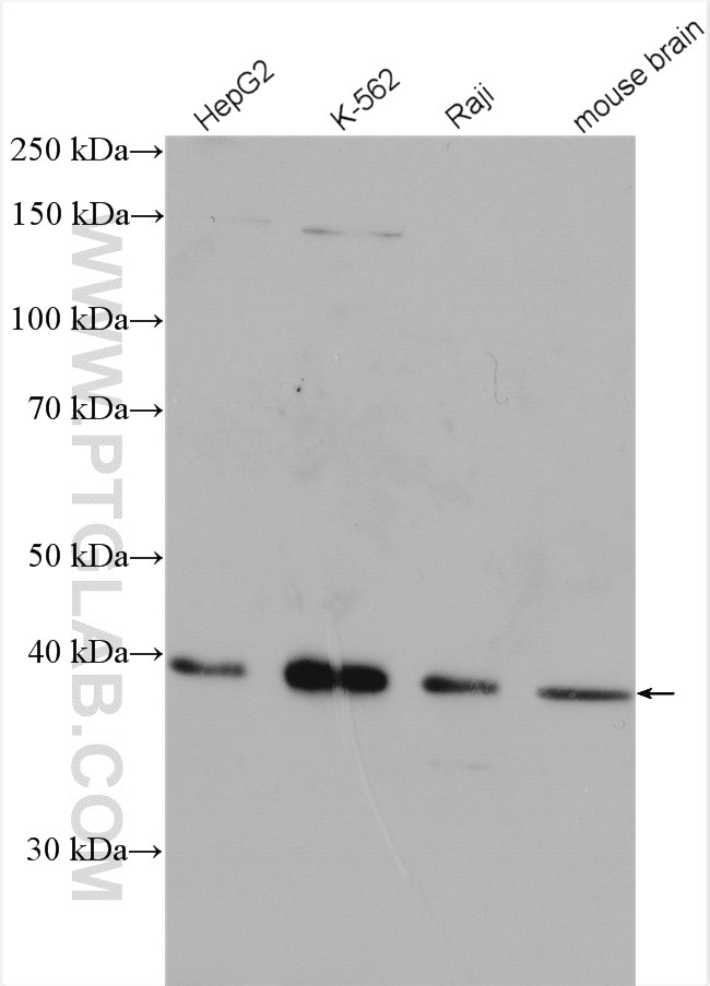 Western Blot (WB) analysis of various lysates using LIAS Polyclonal antibody (11577-1-AP)