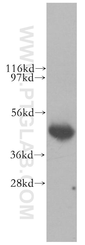 Western Blot (WB) analysis of human brain tissue using LIAS Polyclonal antibody (11577-1-AP)