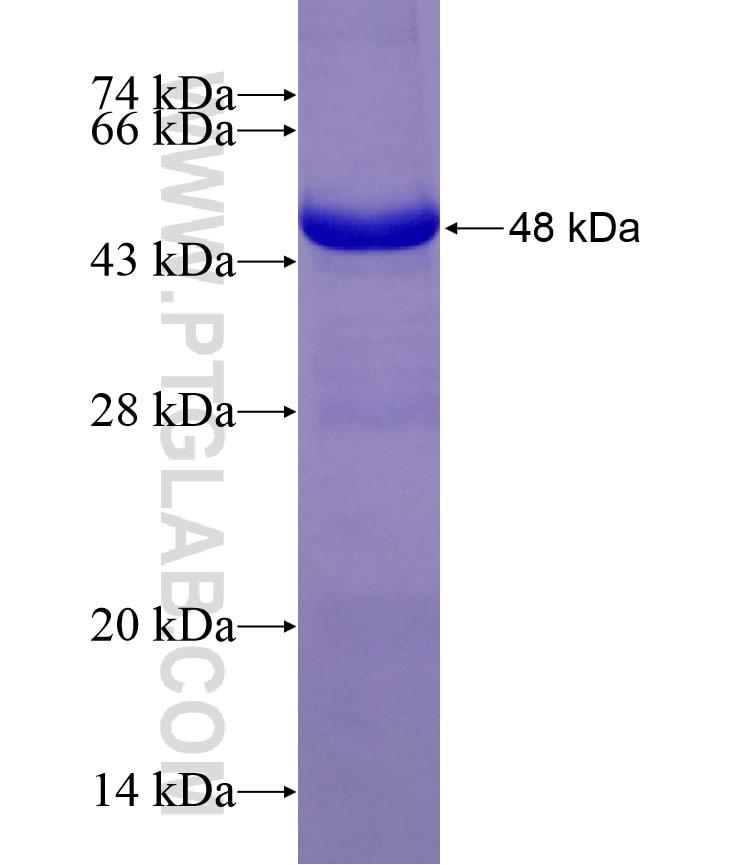 LIAS fusion protein Ag27286 SDS-PAGE