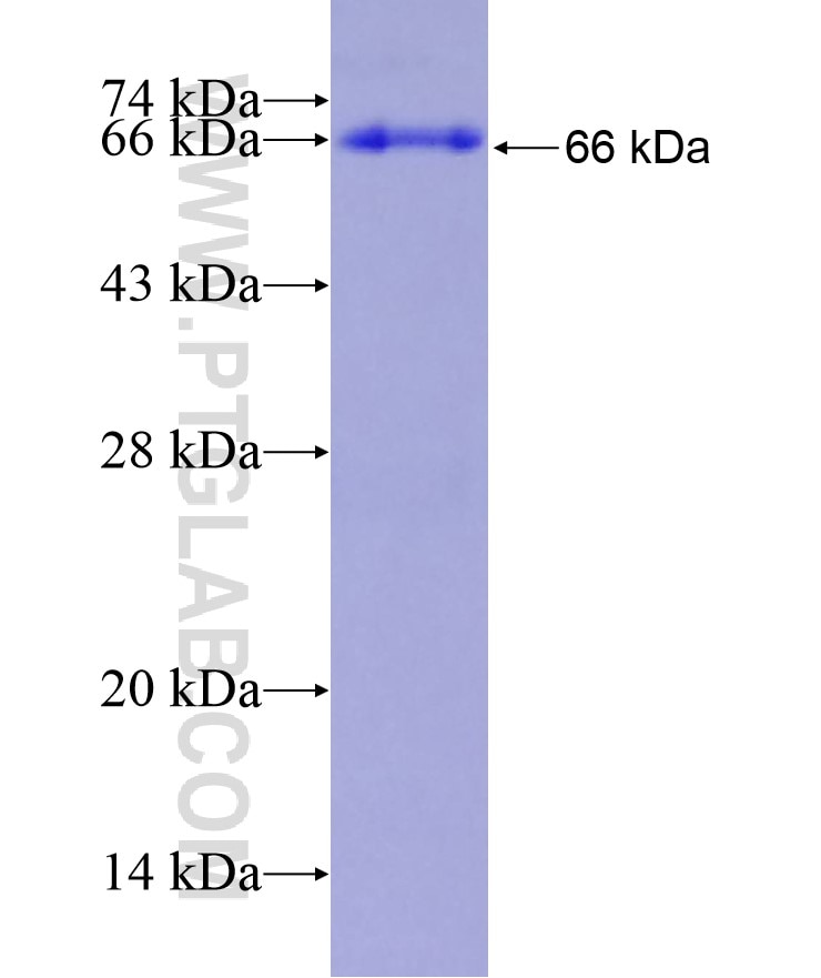 LIAS fusion protein Ag2162 SDS-PAGE