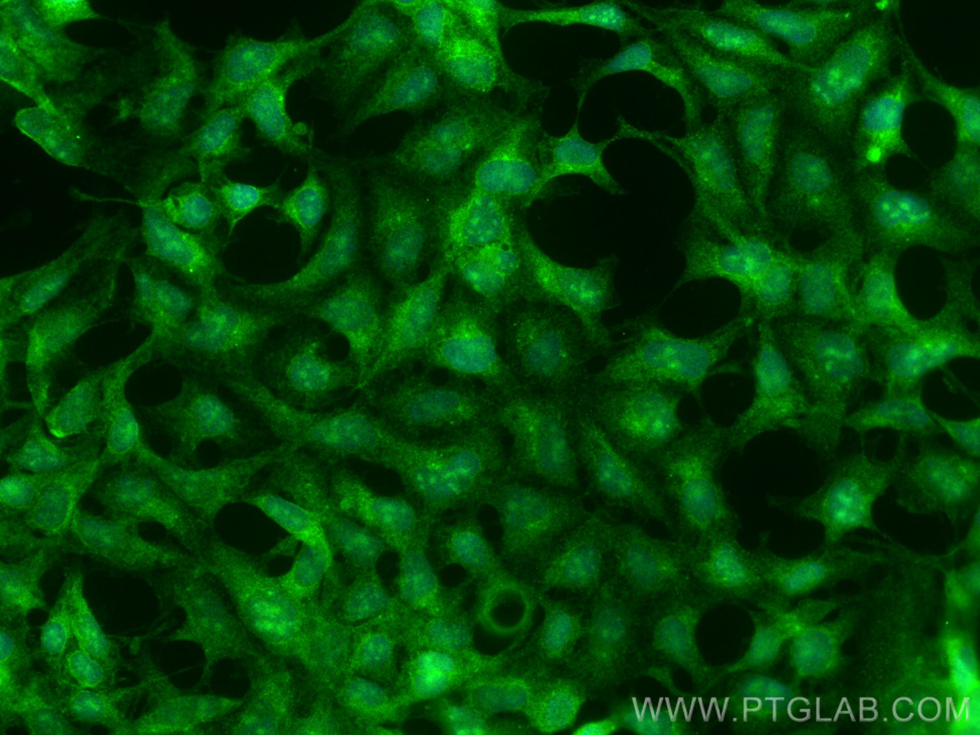 Immunofluorescence (IF) / fluorescent staining of HEK-293 cells using LIAT1 Polyclonal antibody (31796-1-AP)