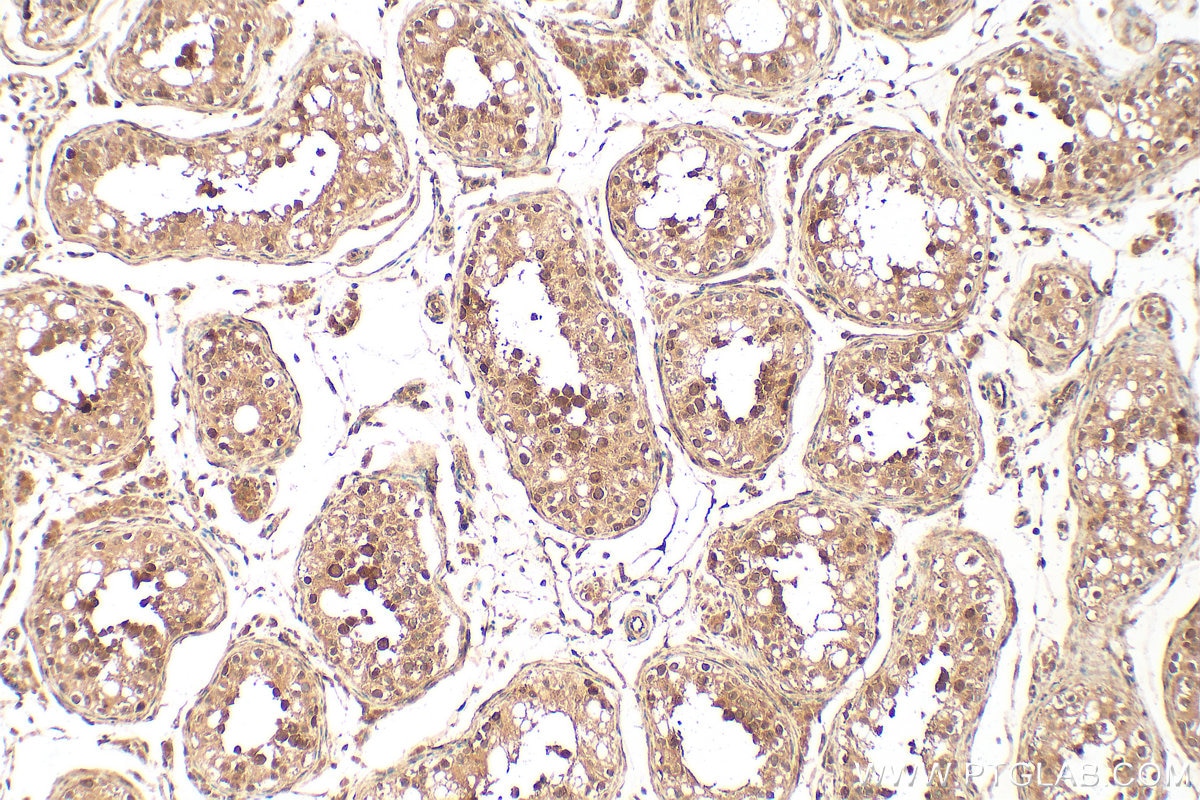 Immunohistochemistry (IHC) staining of human testis tissue using LIAT1 Polyclonal antibody (31796-1-AP)