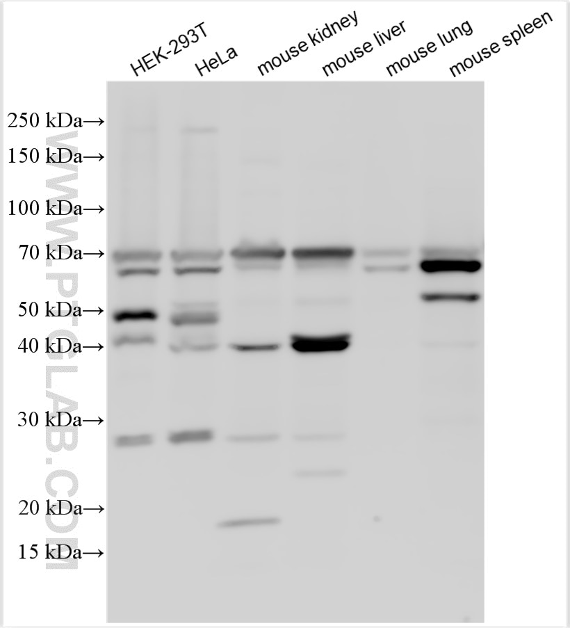 Western Blot (WB) analysis of various lysates using LIAT1 Polyclonal antibody (31796-1-AP)