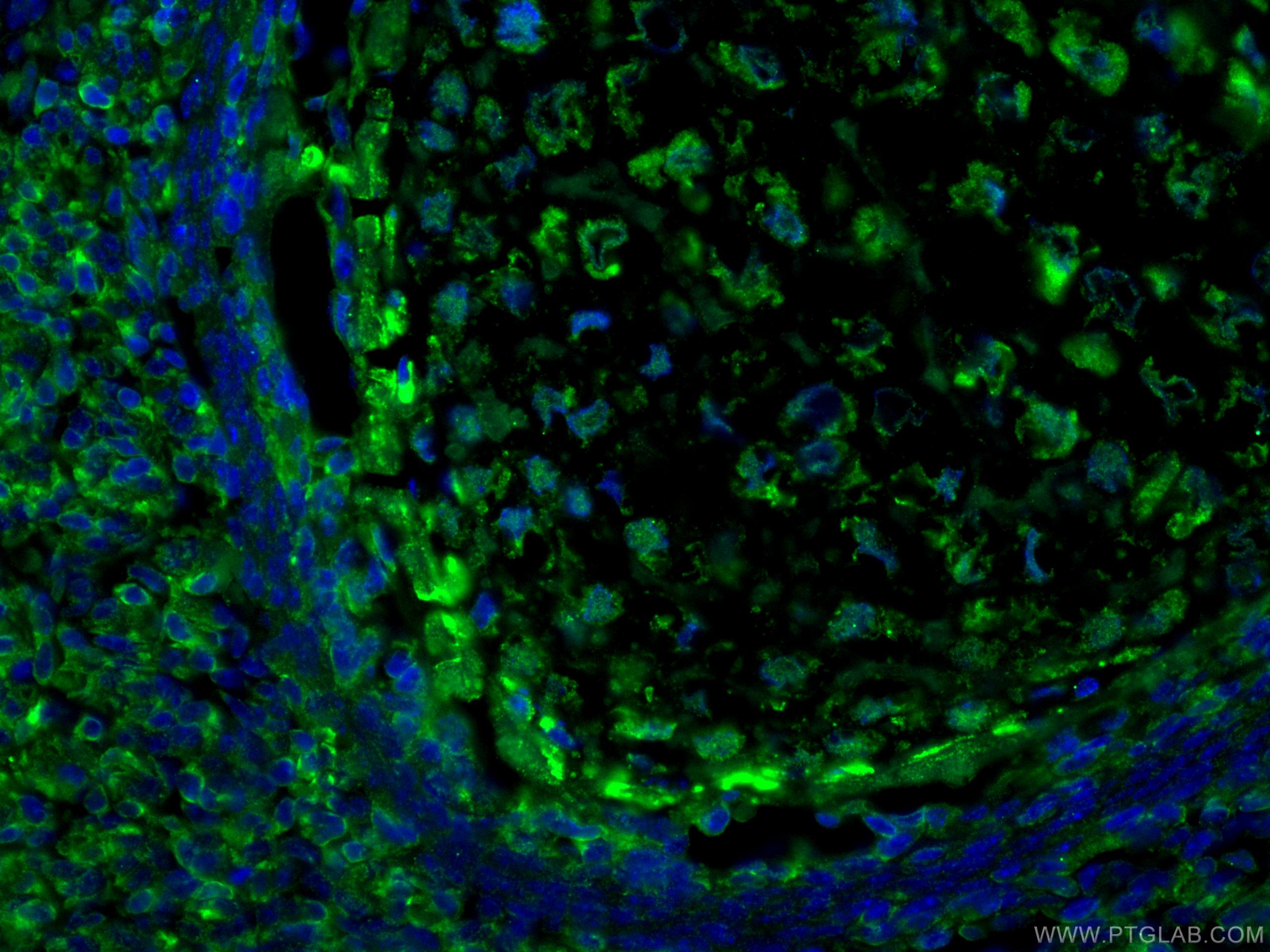 Immunofluorescence (IF) / fluorescent staining of mouse embryo tissue using LIF Polyclonal antibody (26757-1-AP)
