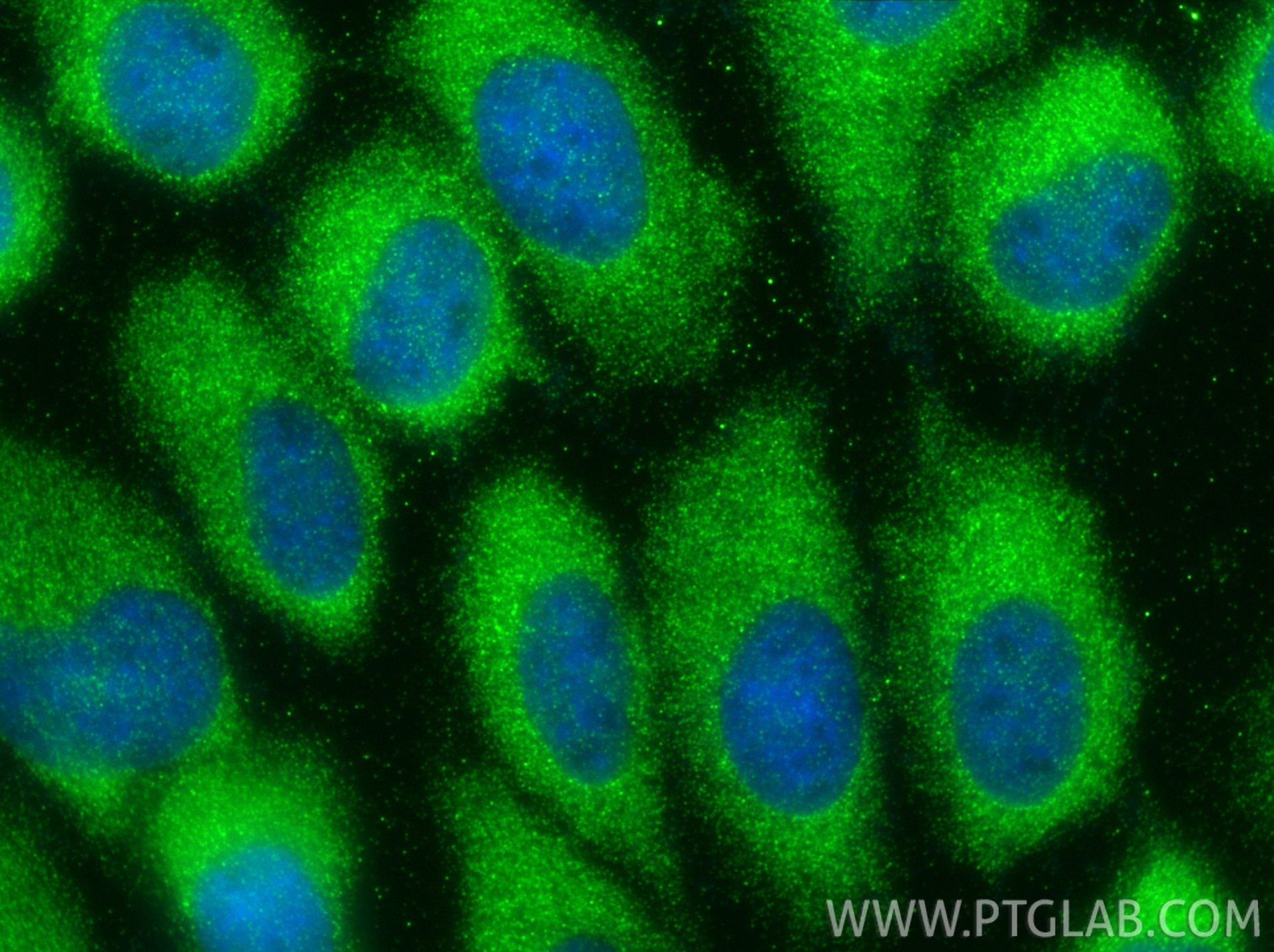 Immunofluorescence (IF) / fluorescent staining of A431 cells using LIF Polyclonal antibody (26757-1-AP)