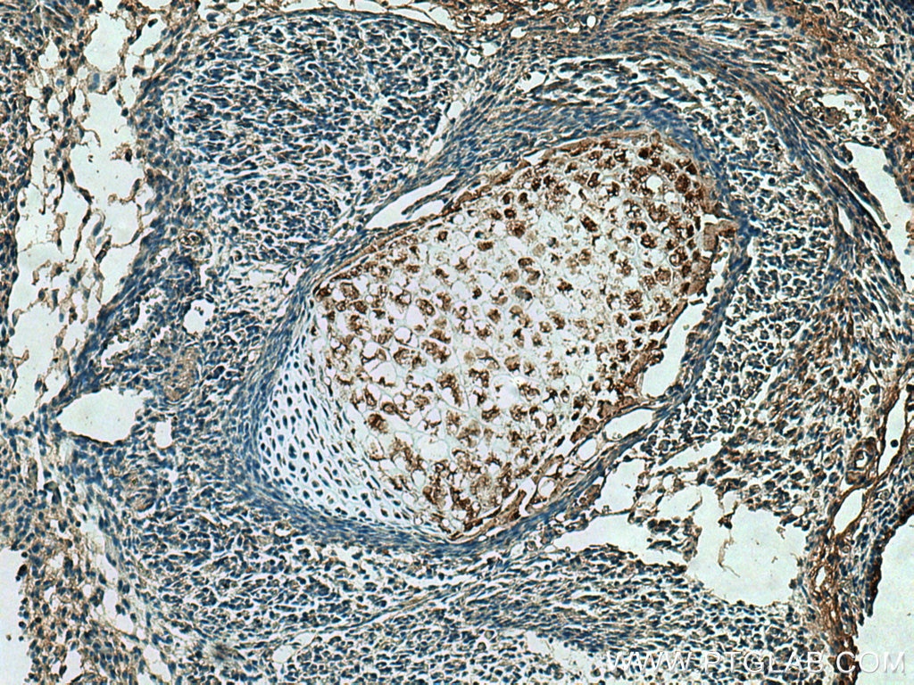 Immunohistochemistry (IHC) staining of mouse embryo tissue using LIF Polyclonal antibody (26757-1-AP)