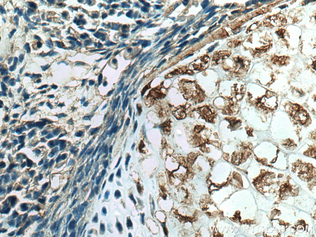 Immunohistochemistry (IHC) staining of mouse embryo tissue using LIF Polyclonal antibody (26757-1-AP)