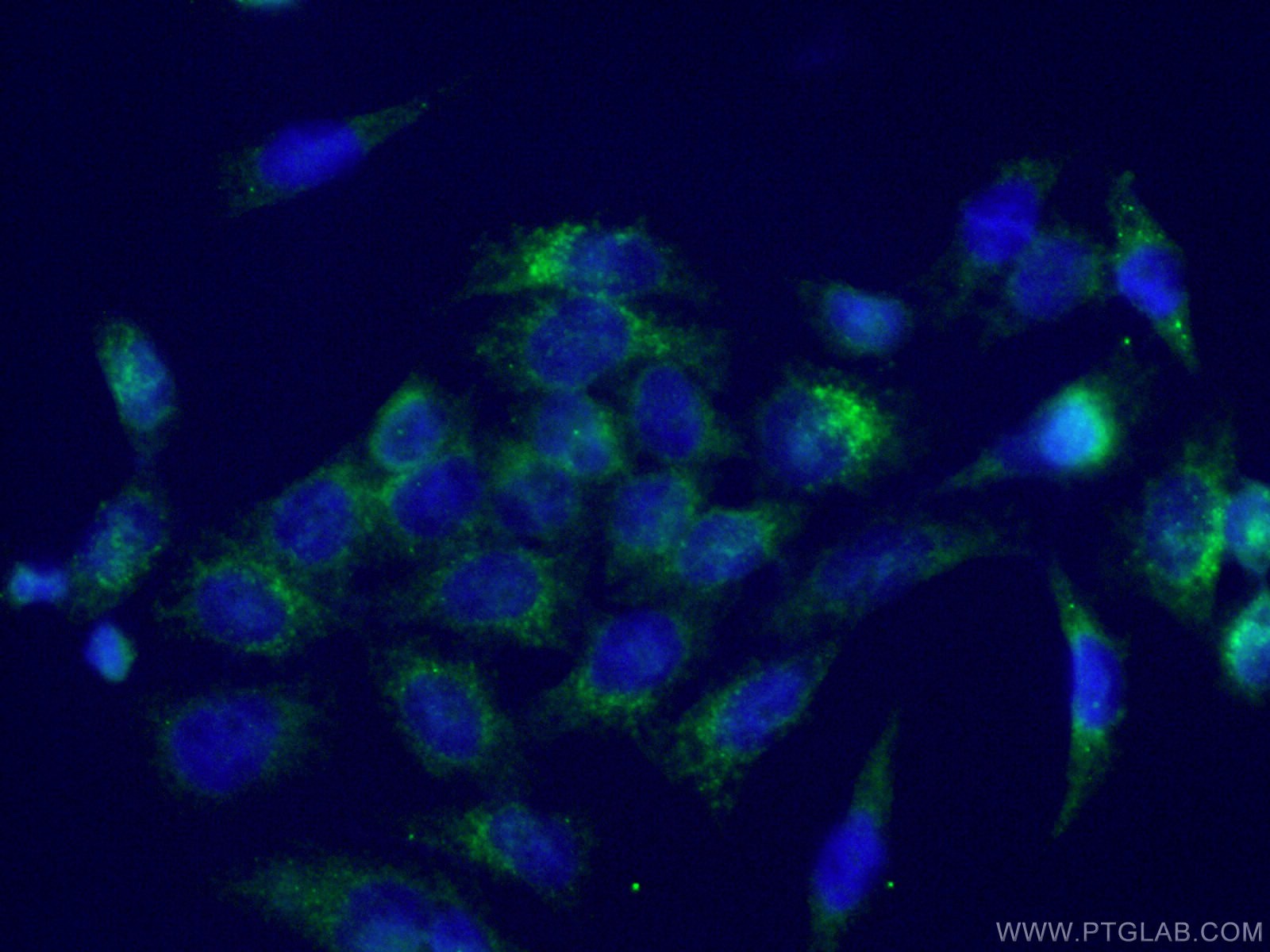 Immunofluorescence (IF) / fluorescent staining of HeLa cells using LIFR Polyclonal antibody (22779-1-AP)
