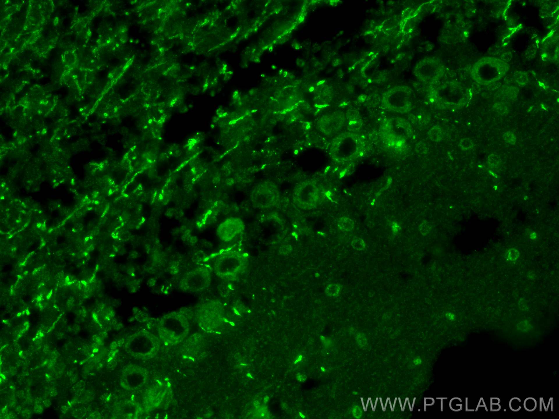 Immunofluorescence (IF) / fluorescent staining of mouse cerebellum tissue using LIFR Polyclonal antibody (22779-1-AP)