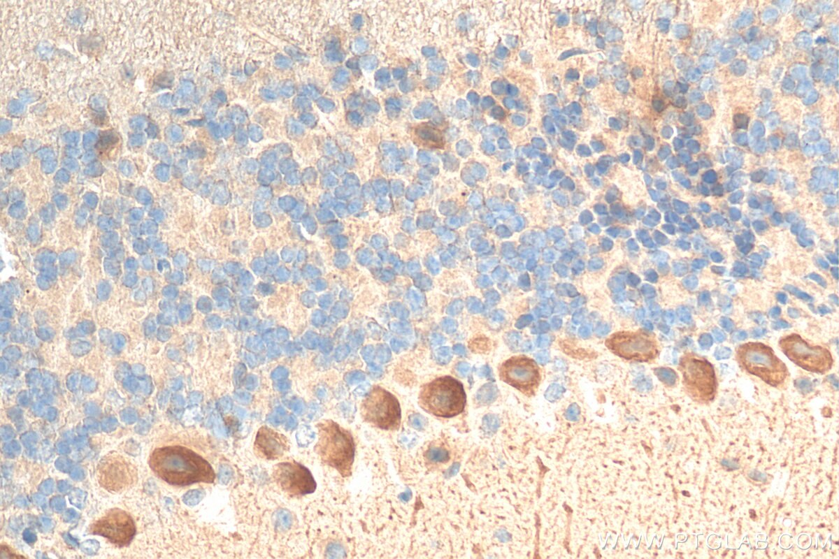 Immunohistochemistry (IHC) staining of mouse cerebellum tissue using LIFR Polyclonal antibody (22779-1-AP)