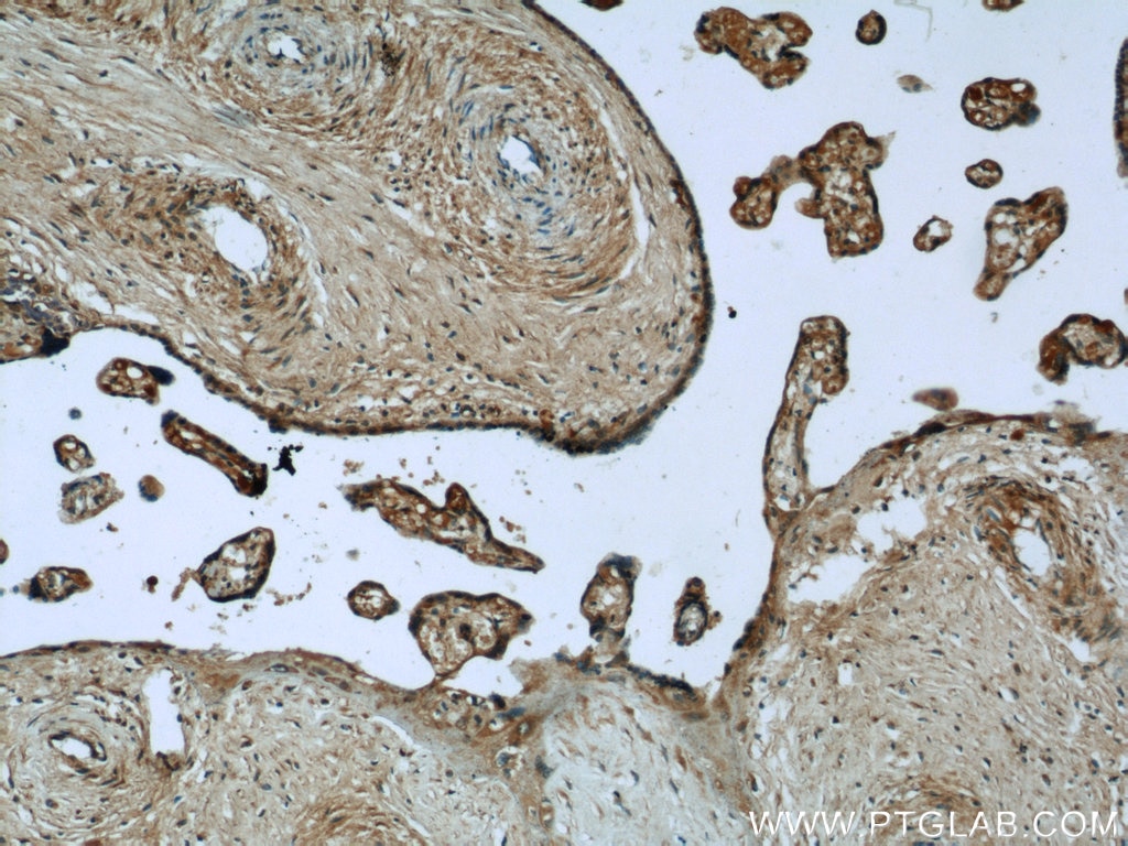 Immunohistochemistry (IHC) staining of human placenta tissue using LIFR Polyclonal antibody (22779-1-AP)