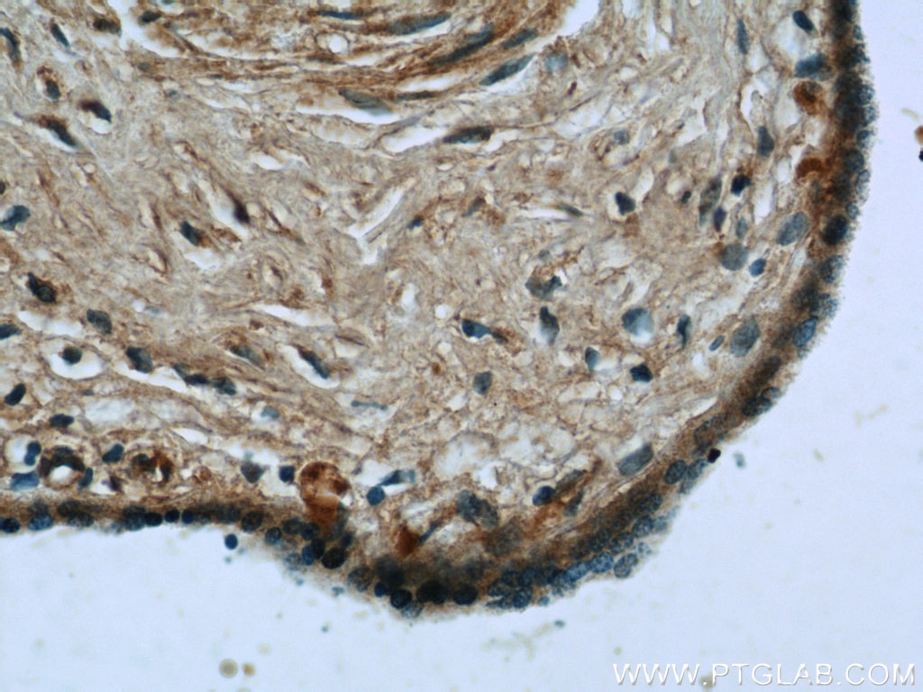 Immunohistochemistry (IHC) staining of human placenta tissue using LIFR Polyclonal antibody (22779-1-AP)