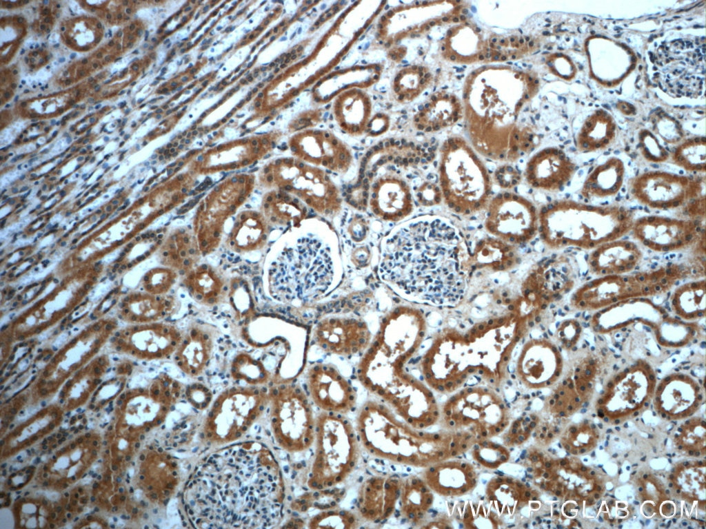 Immunohistochemistry (IHC) staining of human kidney tissue using LIFR Polyclonal antibody (22779-1-AP)
