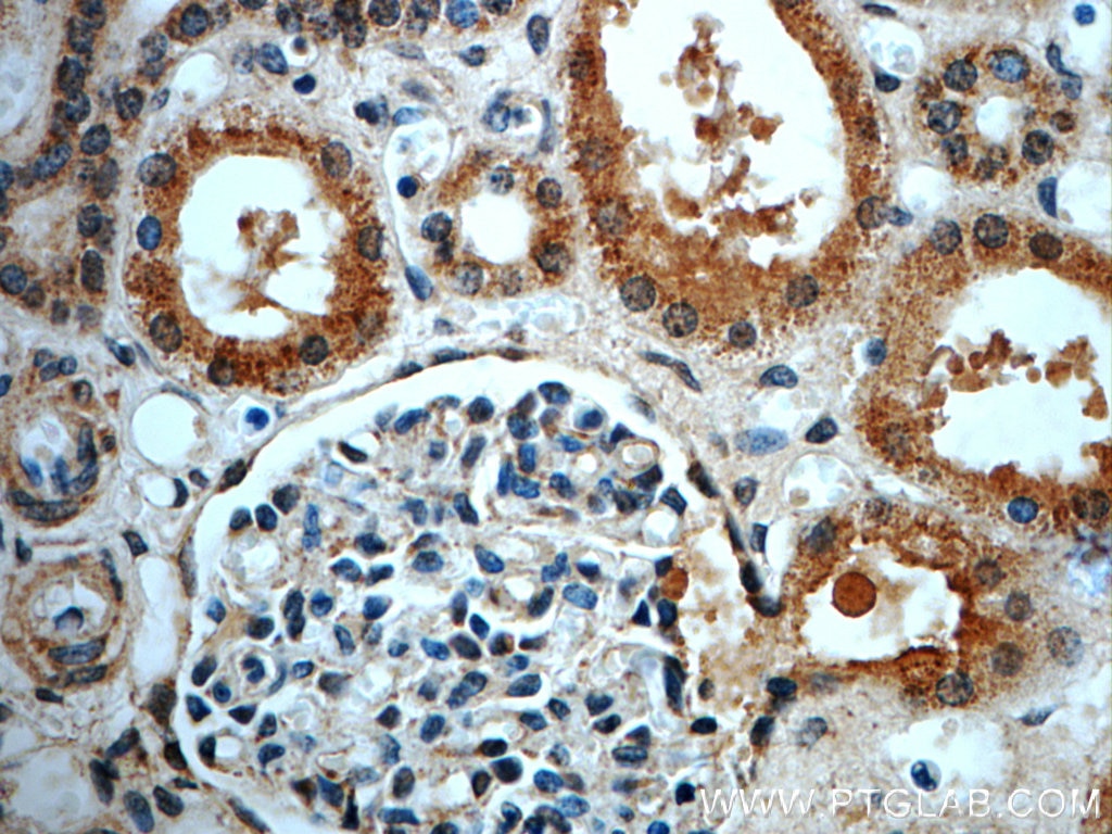 Immunohistochemistry (IHC) staining of human kidney tissue using LIFR Polyclonal antibody (22779-1-AP)