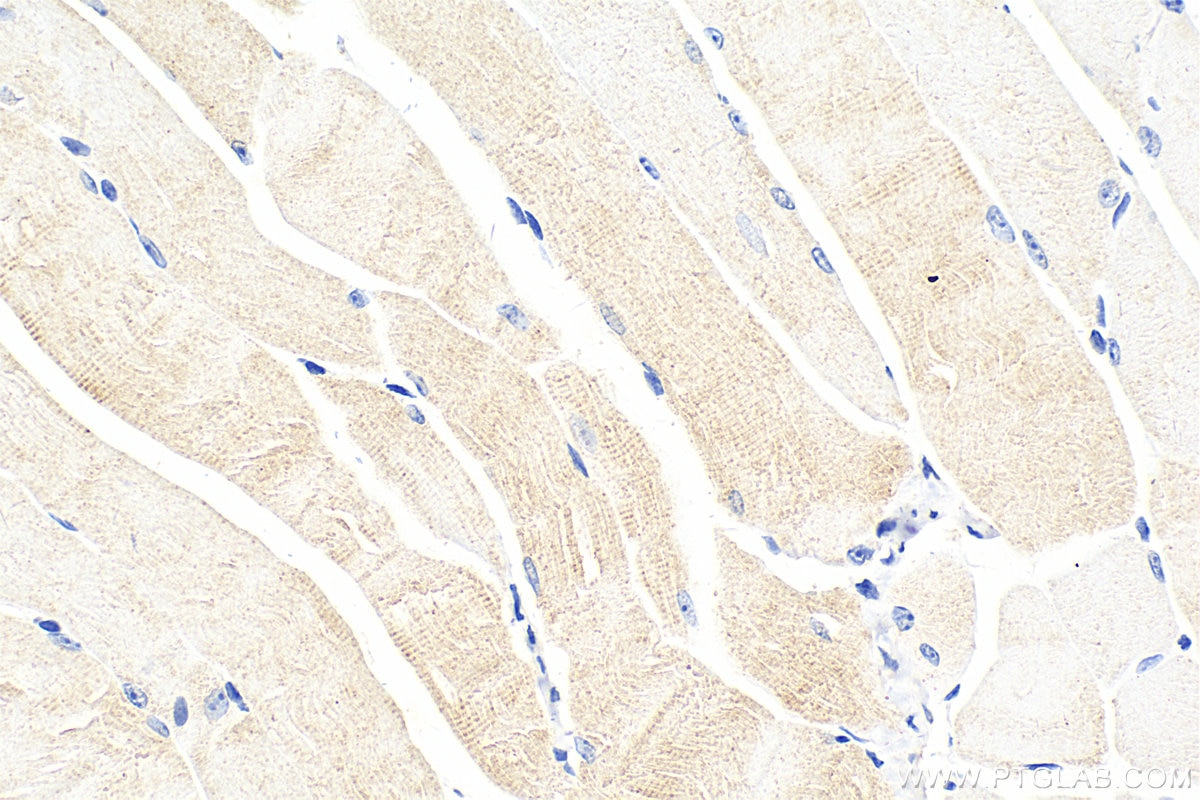 Immunohistochemistry (IHC) staining of mouse skeletal muscle tissue using LIFR Polyclonal antibody (22779-1-AP)
