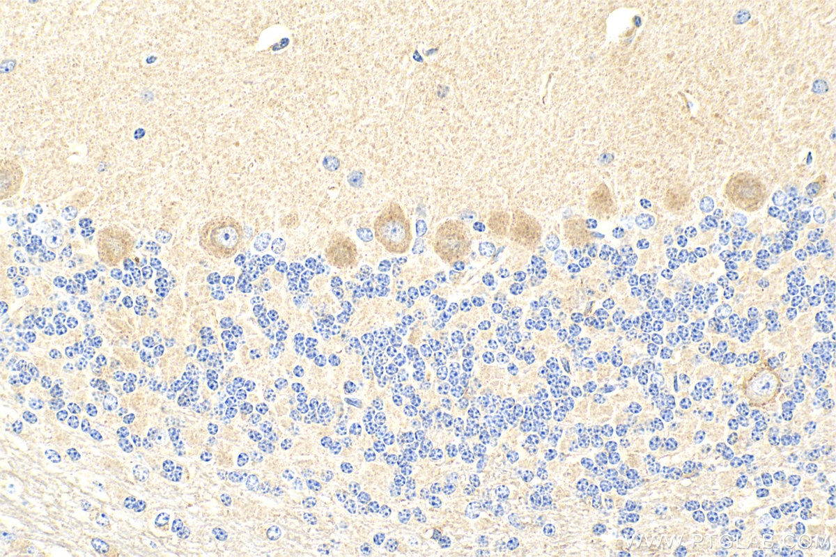 Immunohistochemistry (IHC) staining of mouse cerebellum tissue using LIFR Polyclonal antibody (22779-1-AP)