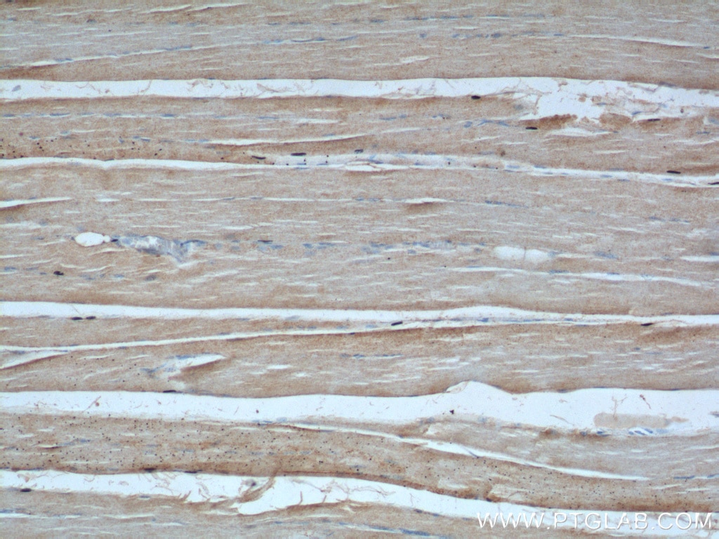 Immunohistochemistry (IHC) staining of human skeletal muscle tissue using LIFR Polyclonal antibody (22779-1-AP)