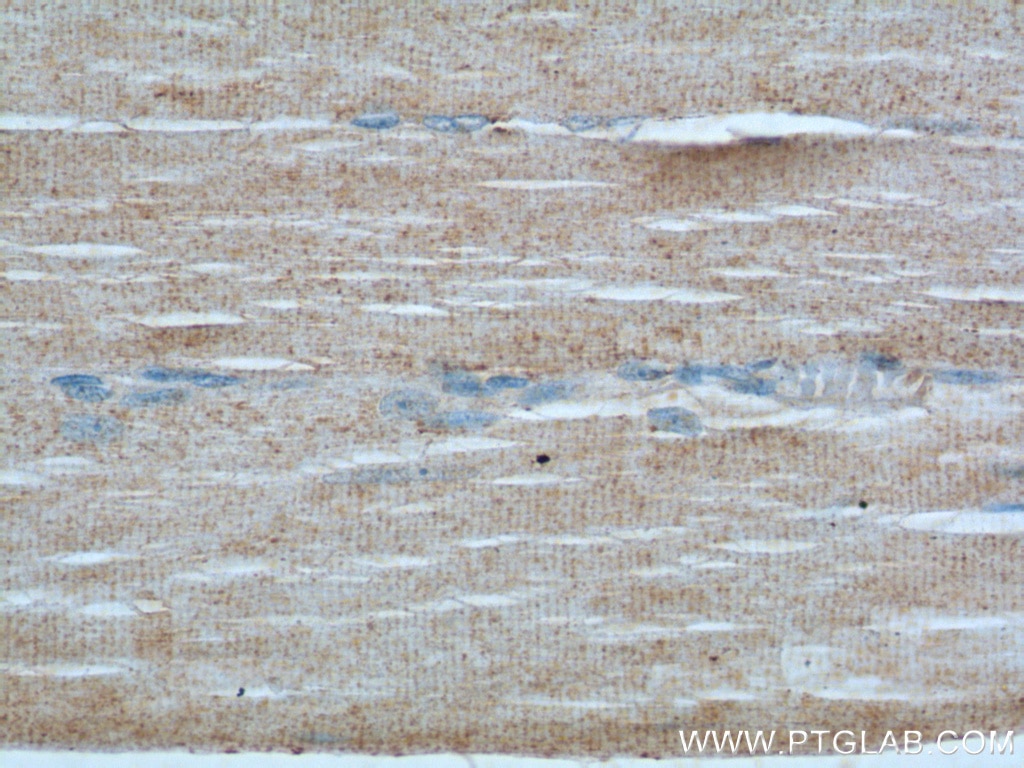 Immunohistochemistry (IHC) staining of human skeletal muscle tissue using LIFR Polyclonal antibody (22779-1-AP)