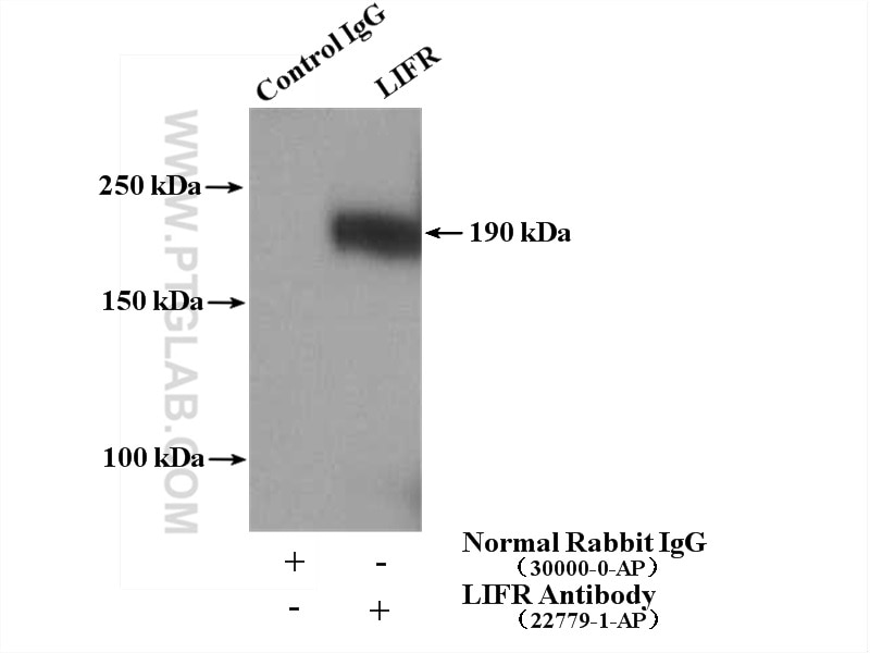 Immunoprecipitation (IP) experiment of mouse skeletal muscle tissue using LIFR Polyclonal antibody (22779-1-AP)