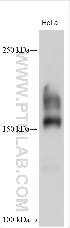 Western Blot (WB) analysis of various lysates using LIFR Polyclonal antibody (22779-1-AP)