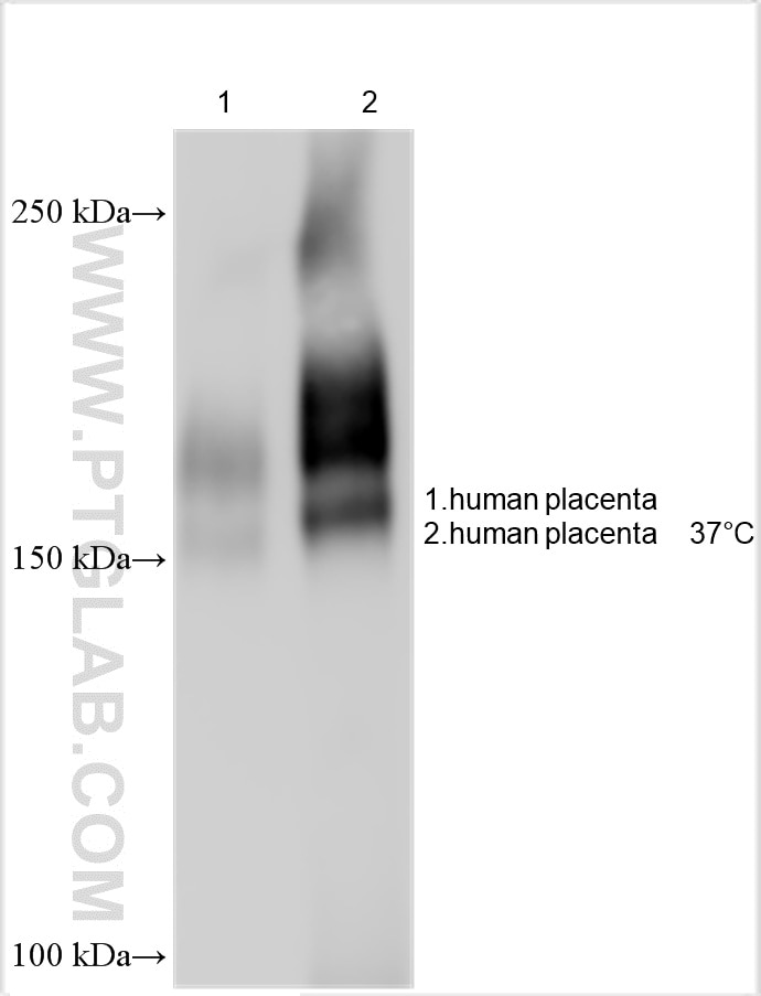 Western Blot (WB) analysis of various lysates using LIFR Polyclonal antibody (22779-1-AP)