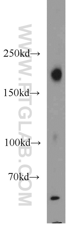 Western Blot (WB) analysis of mouse skeletal muscle tissue using LIFR Polyclonal antibody (22779-1-AP)